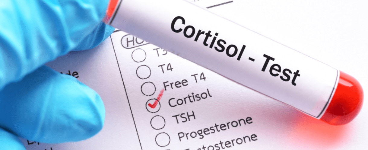 Avant de faire tester ses hormones si l’on a un problème de peau