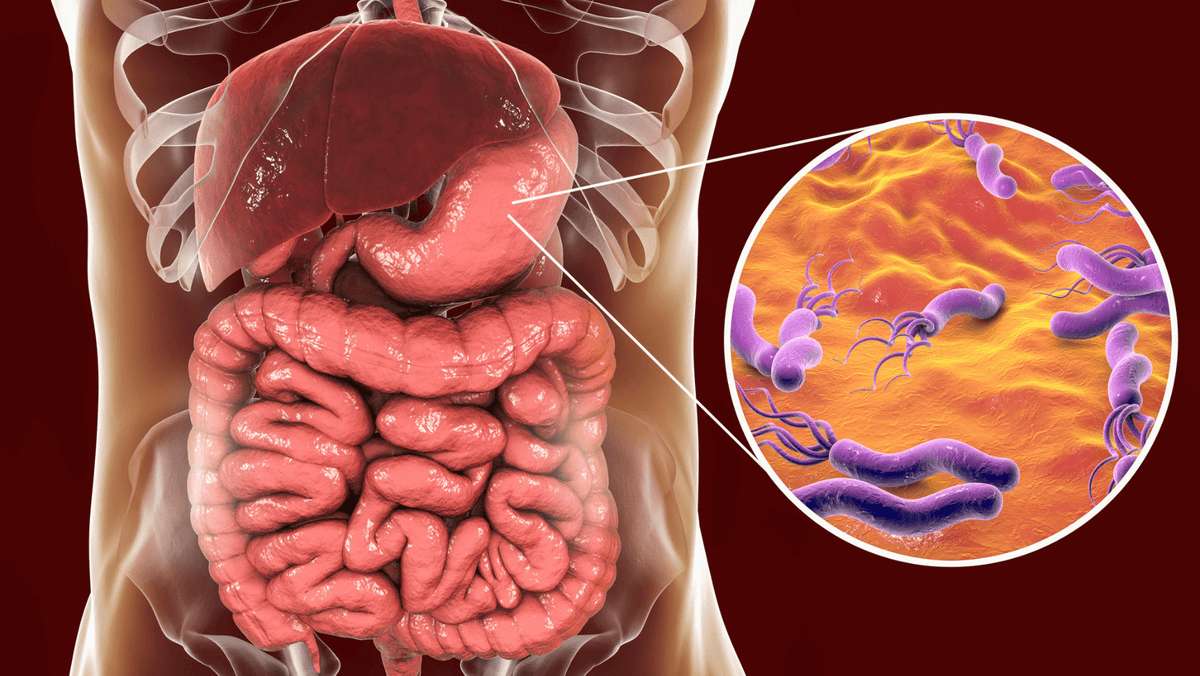 Acné rosacée, eczéma, psoriasis et urticaire... Et si le coupable était l'Helicobacter Pylori